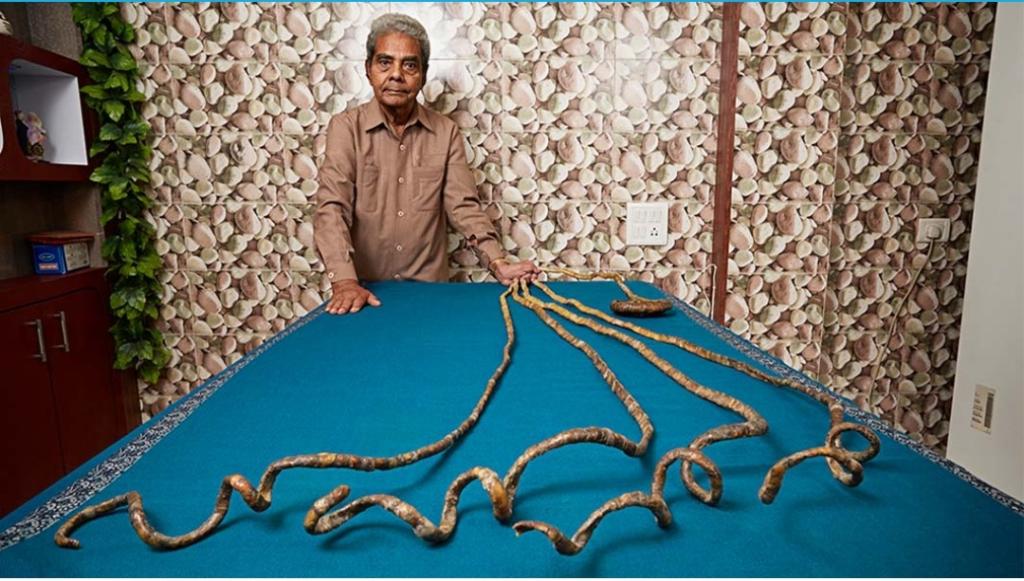 Indian Man’s Extraordinary Fingernails Earn Place in Guinness World Records History