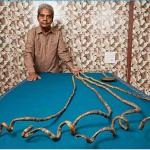 Indian Man’s Extraordinary Fingernails Earn Place in Guinness World Records History